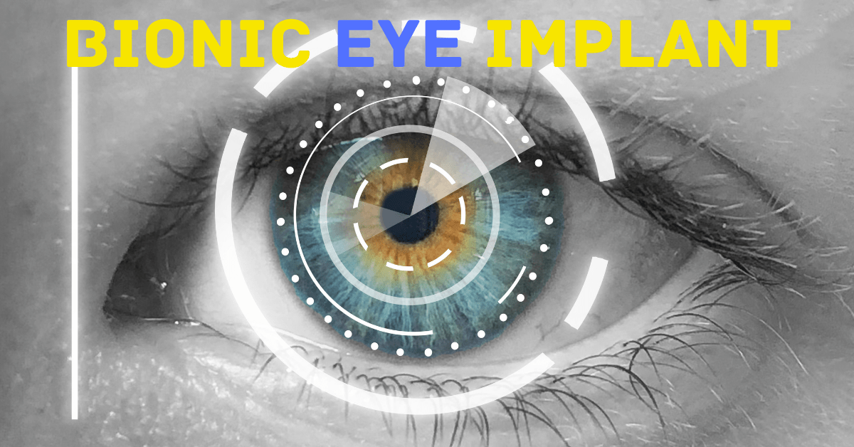 bionic eye